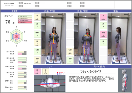 からだバランス画像解析