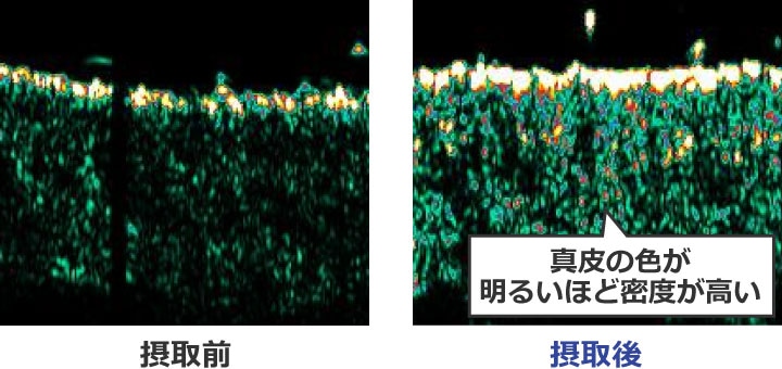 ドリンク 有効性【真皮密度】