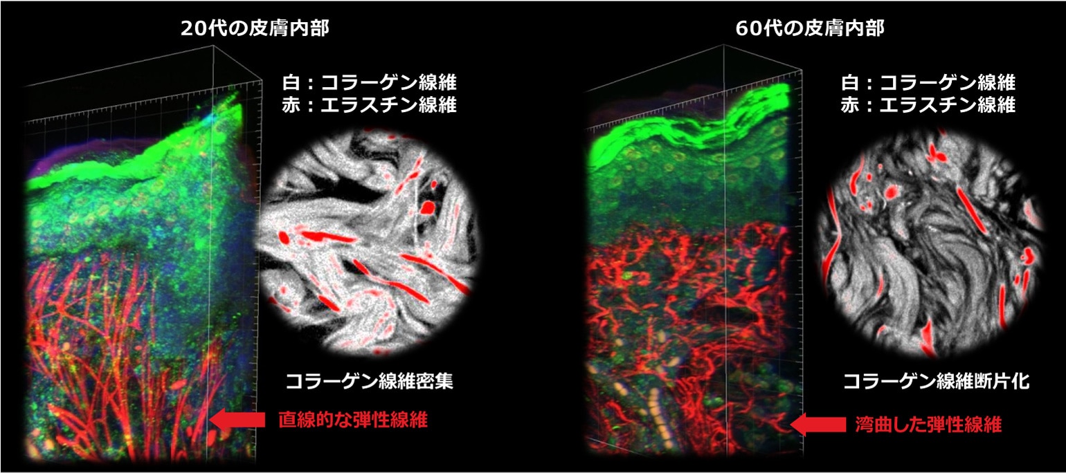 年齢による皮膚コラーゲンおよびエラスチンの構造変化