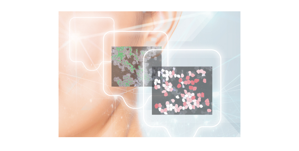 “AIパーソナル角層解析”カウンセリング