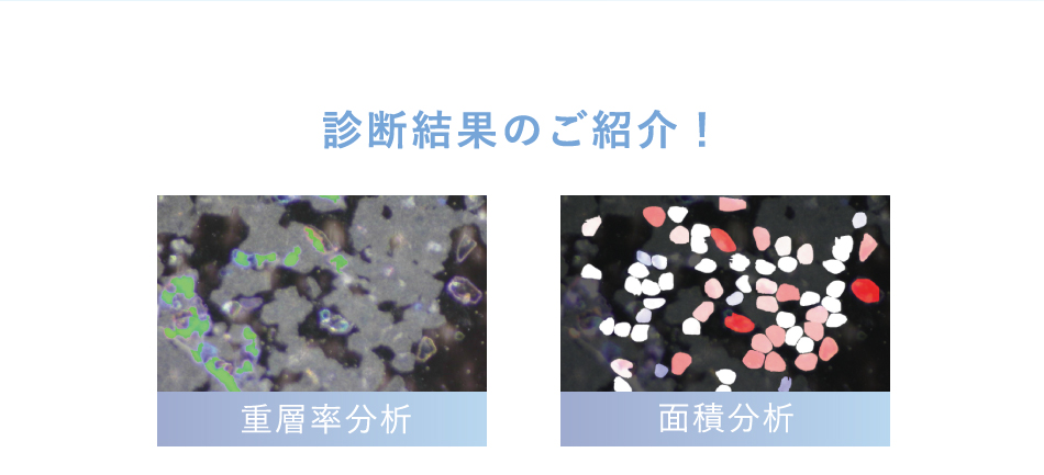 診断結果のご紹介！重層率分析／面積分析